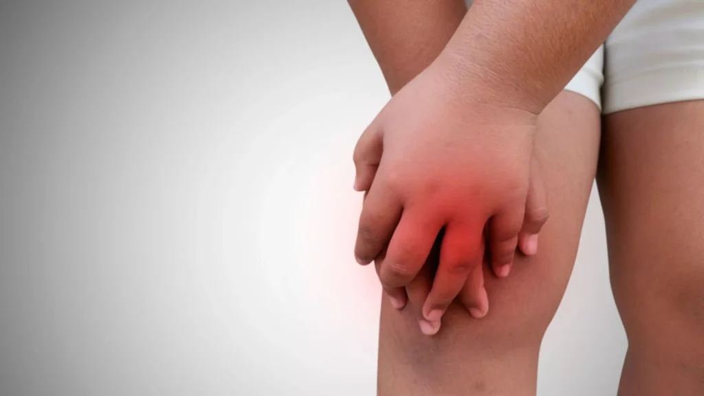Juvenile Idiopathic Arthritis | HeLovesMath Close-up of child holding inflamed knee with visible redness, representing juvenile idiopathic arthritis pain and treatment