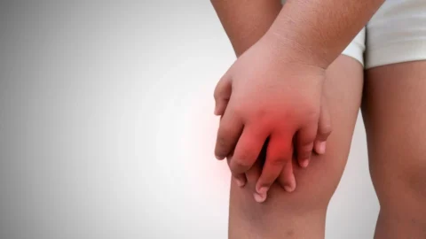 Juvenile Idiopathic Arthritis | HeLovesMath Close-up of child holding inflamed knee with visible redness, representing juvenile idiopathic arthritis pain and treatment